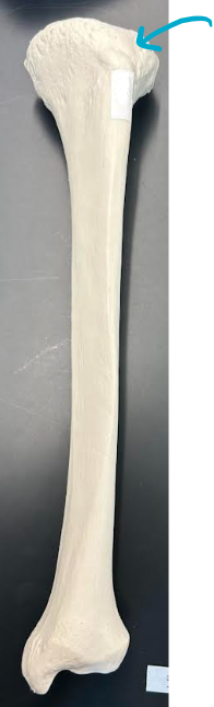 <p>ID tibia region </p>