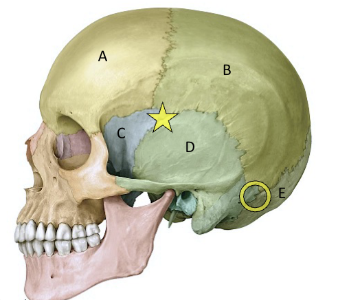 <p>Pterion (star)</p>