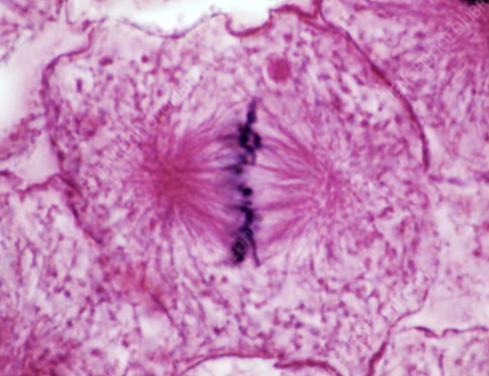 <p>what stage of mitosis is this</p>