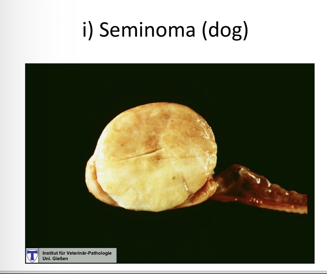 <p>Seminoma gross </p>