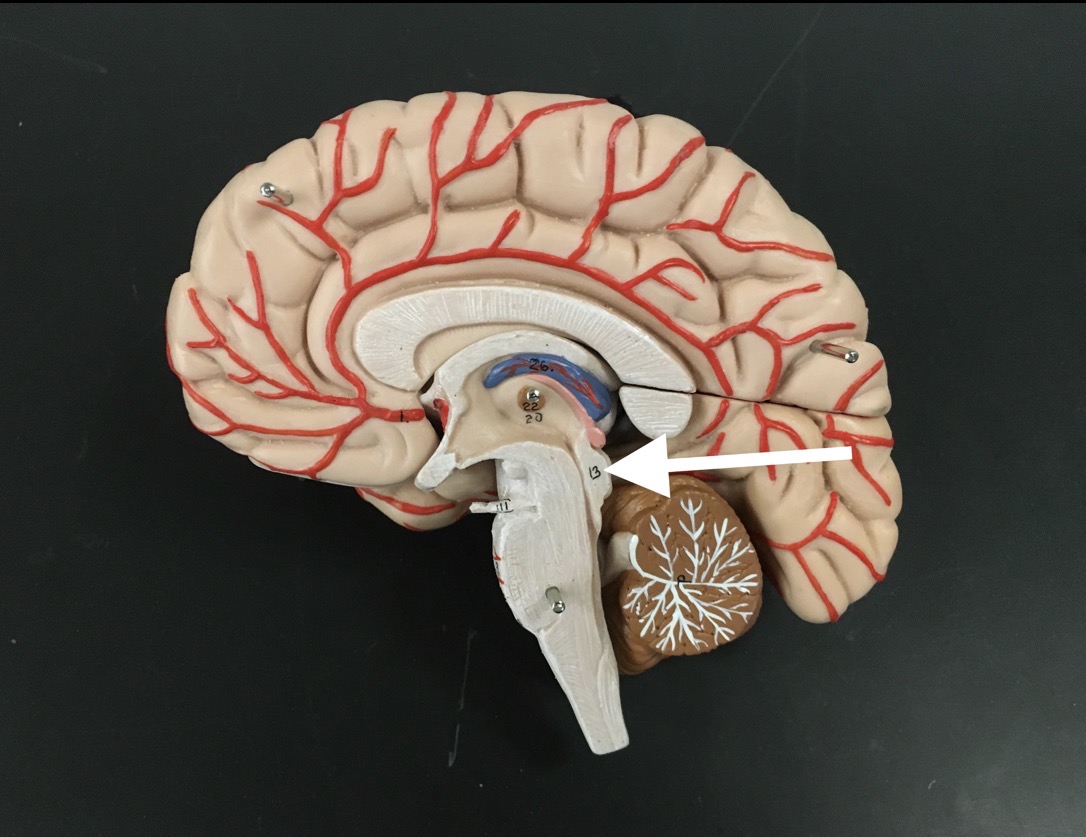 <p>What is the arrow pointing to?</p>