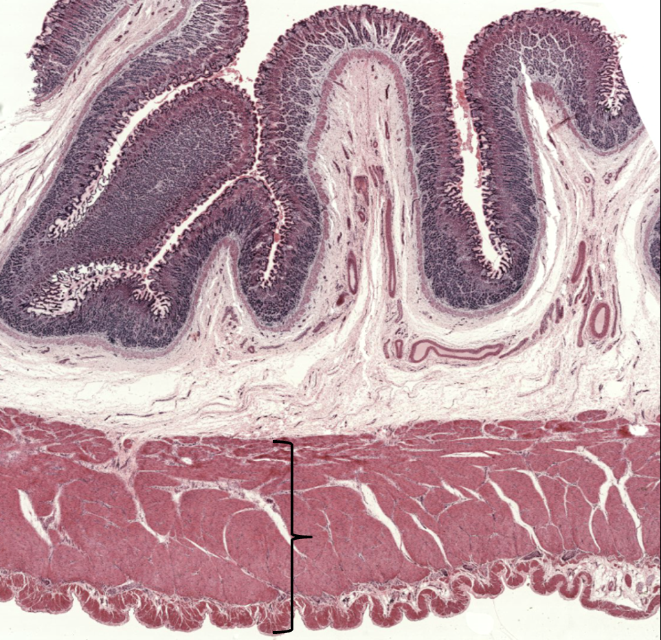 <p>What layer is this?</p>