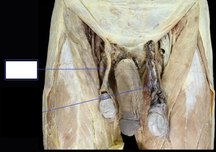 <p>Identify</p><p>Side Question:</p><p>Structure found in this?</p>