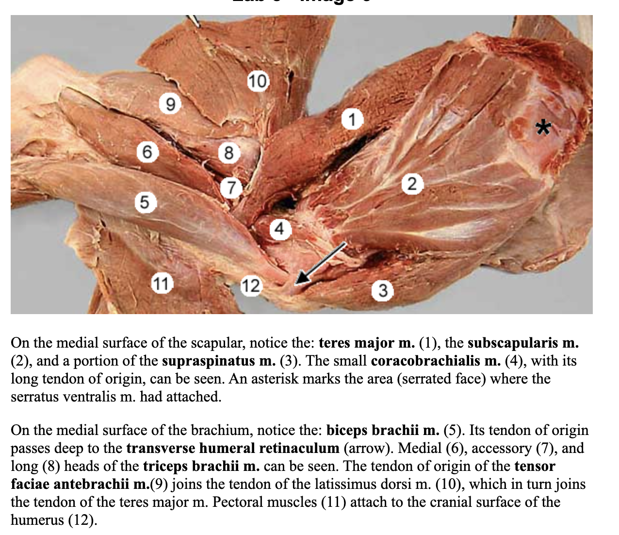 <p>attachments: supraglenoid tubercle of the scapula and proximal radius and ulna in combination with the tendon of the brachialis muscle</p><p>held in place by<strong> transverse humeral retinaculum (bridge looking foramen)</strong></p><p>action: flex the elbow joint; extend the shoulder joint</p><p>nerve: musculocutaneous nerve </p><p>blood: brachial artery </p>