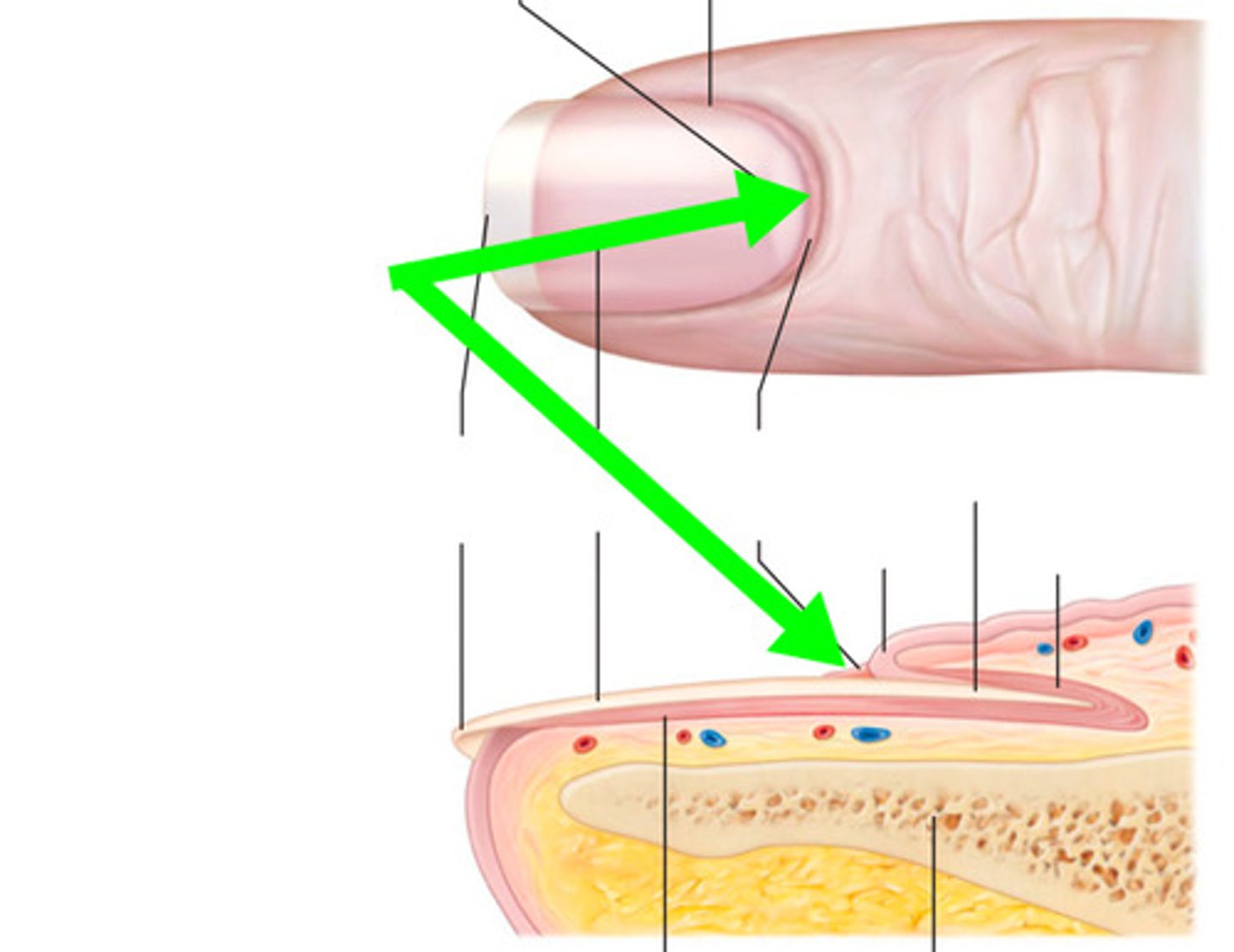 <p>Dead, colorless tissue attached to the natural nail plate.</p>