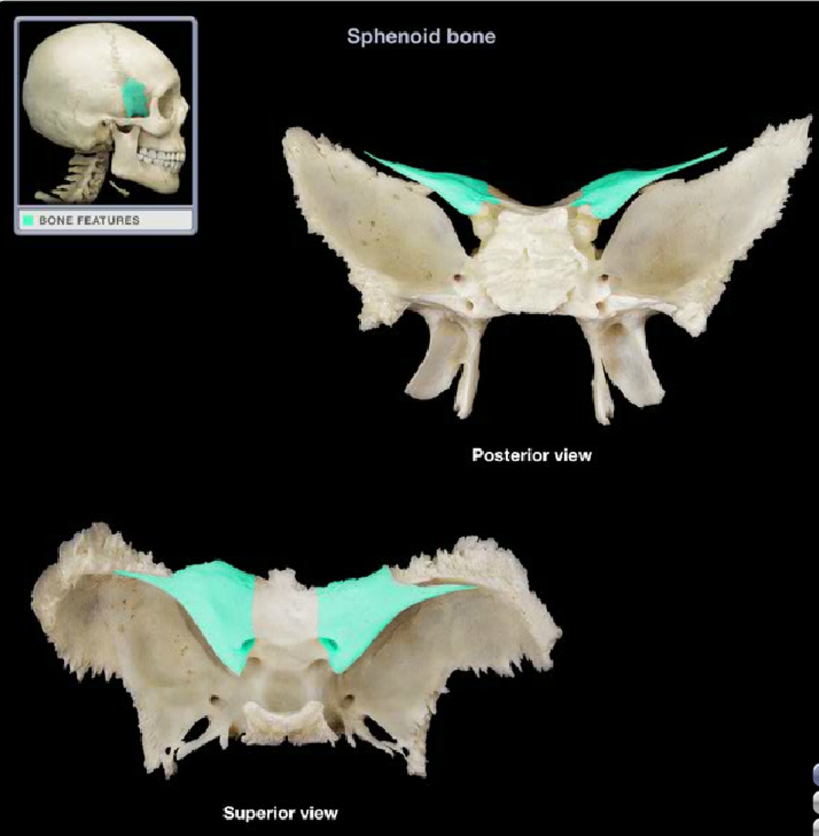 <p>What boney feature is this?</p>