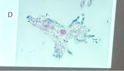 <p>What is this organism?</p>