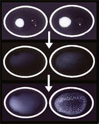 <p>Passive Agglutination (or EIA)</p>