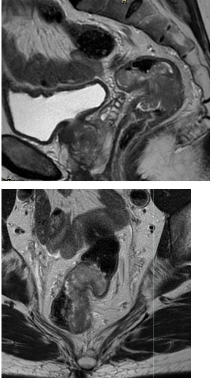 <ol><li><p>Imenuj tehniko slikanja </p></li><li><p>Naštej anatomske strukture, prikazane na sliki </p></li><li><p>Kateri je položaj slikanja? </p></li><li><p>Opiši patološke spremembe na sliki</p></li><li><p>Diagnoza?</p></li></ol><p></p>