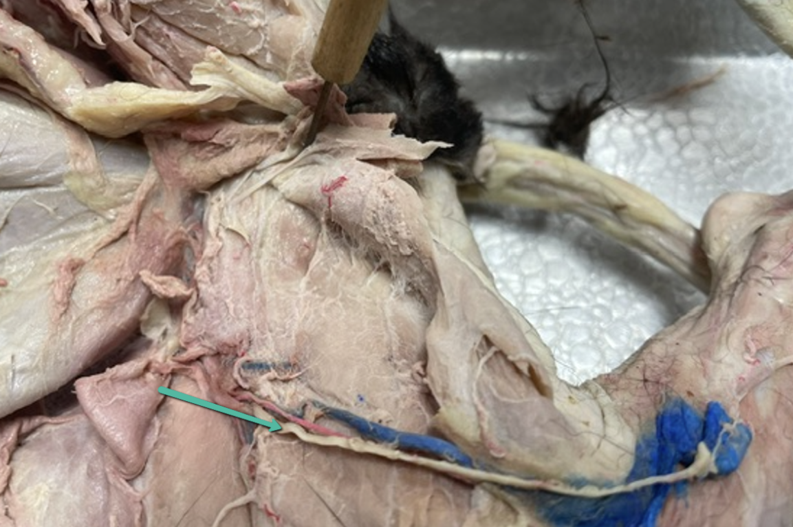 <p><span>Identify the nerve indicated by the pointer.</span></p>