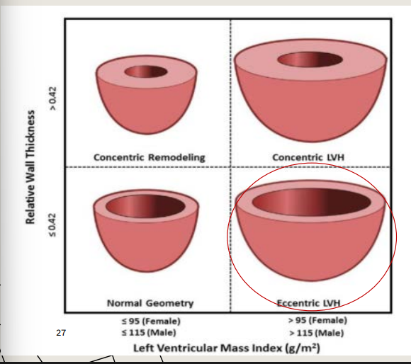 <p>Size, shape, structure, function</p><ul><li><p>LV mass</p></li></ul><p>• LV enlargement</p><p>(Eccentric LVH, normal to thin walls - leads to cardiomegaly)</p>