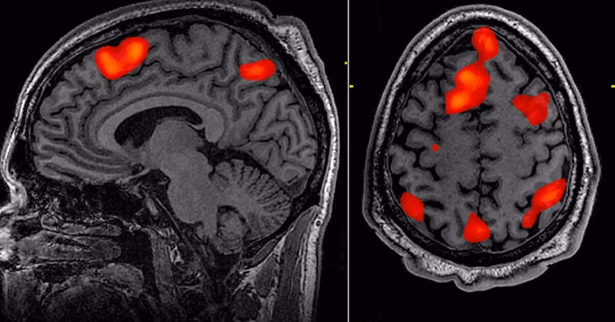 <p>fMRI</p>