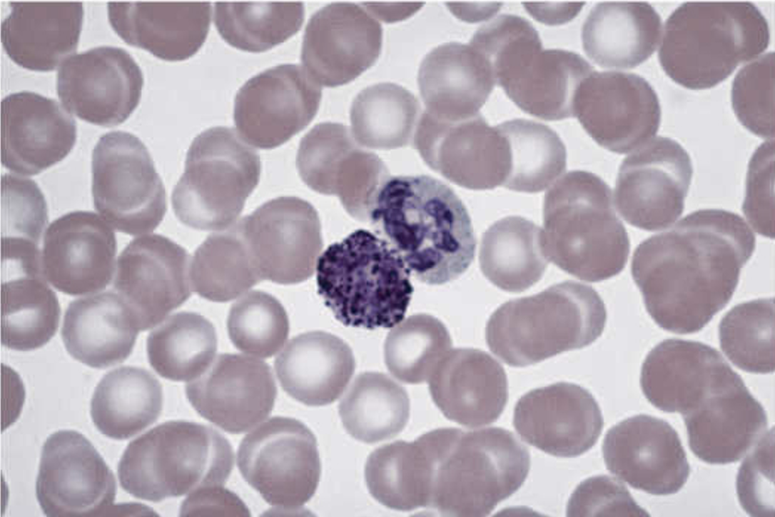 <p>Circle on left</p>