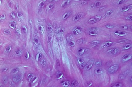 <p>intervertebral disc, pubic symphysis</p>