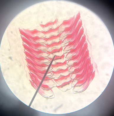 <p>What Phylum is this and what is its name?</p>