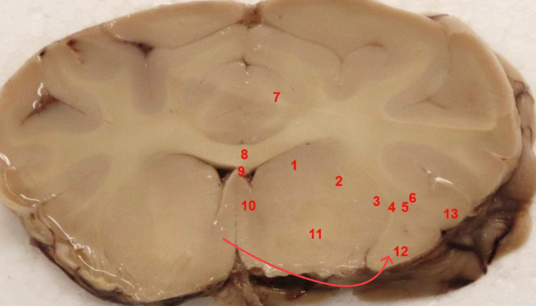 <p>what cortex is this?</p>