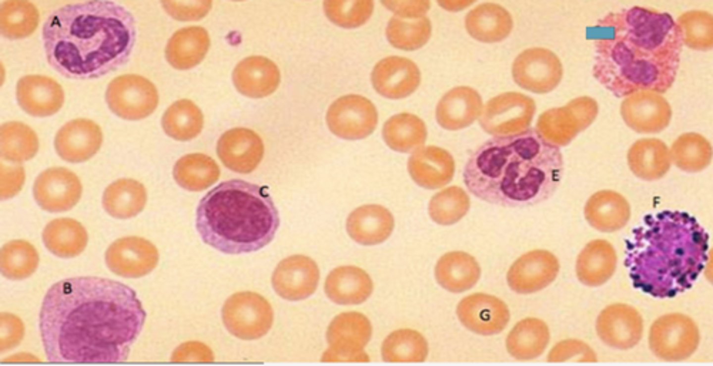<p>Identify the following blood-formed element</p>