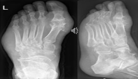 <p>What pathology is shown?</p>