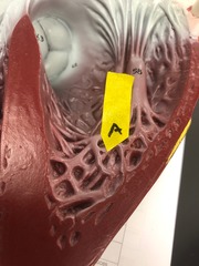 <p>Identify these muscular ridges.</p>