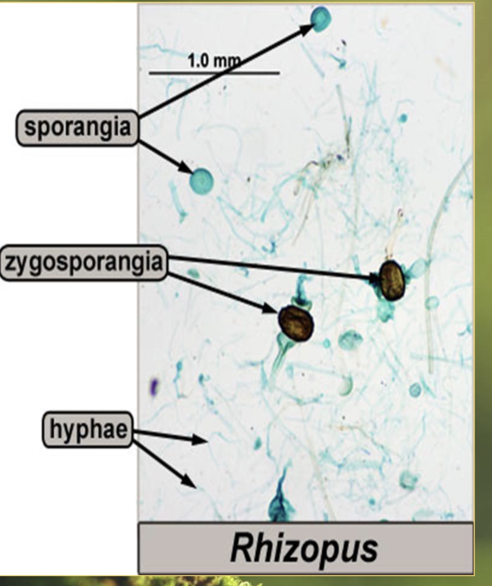 <p>sexual = zygosporangium</p><p>asexual = sporangia</p>