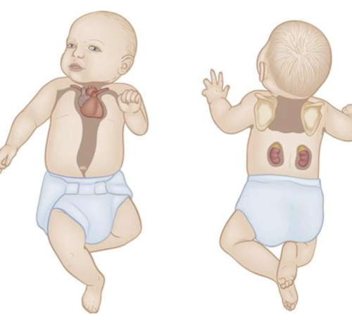 <ul><li><p>they dont shiver </p></li><li><p>primary heart production is in infants thru non-shivering thermogenesis (NST)</p></li><li><p>NST is the metabolism of brown adipose tissue (BAT) to produce heat </p></li></ul><p></p>
