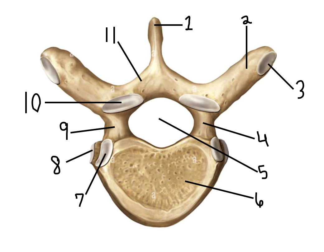 <p>What part is indicated by #10?</p>