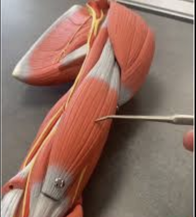 <p>Biceps Brachii</p>