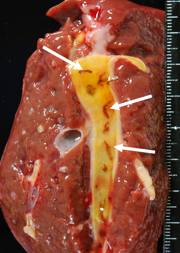 <p><span style="color: blue;"><em>Dicrocoelium dendriticum</em>: Disease, causes this seen in the picture</span></p>