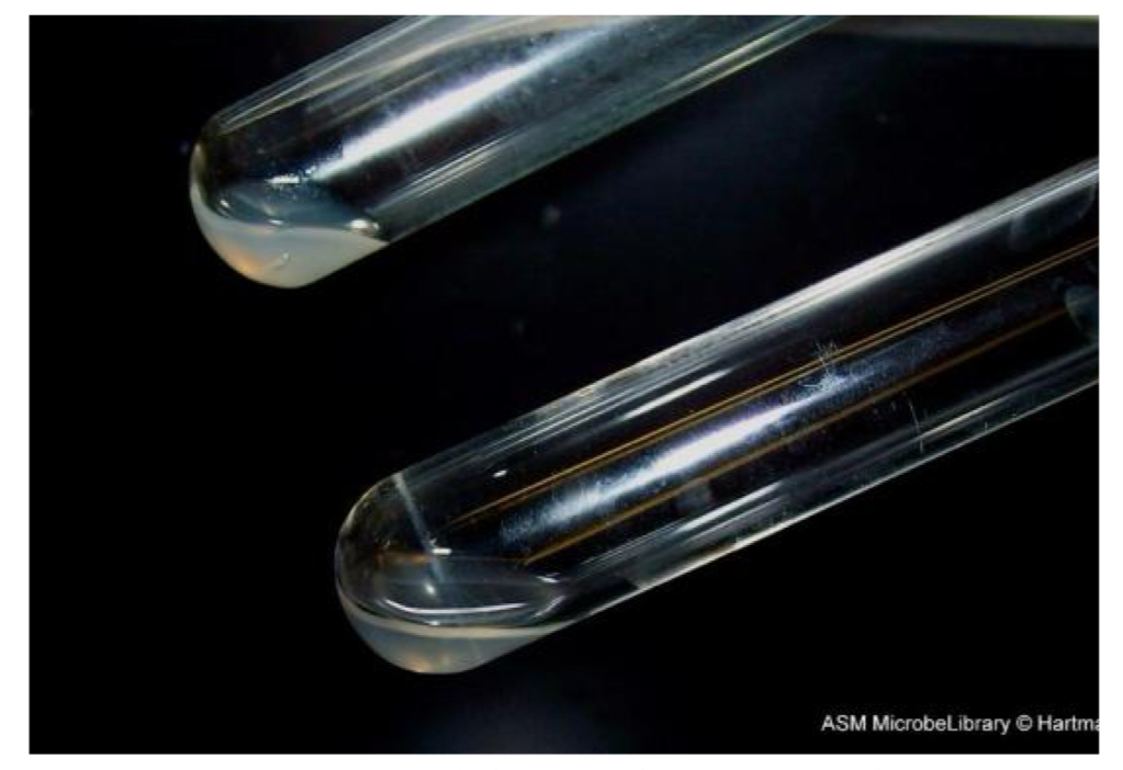 <p>Which tube indicates a positive coagulase test? </p>