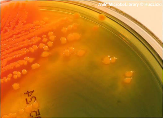 <p>Bright orange to salmon-pink</p><p></p><p>Rapidly ferment one or more of the sugars (lactose, sucrose, salicin), causing an acid drop in pH.</p>