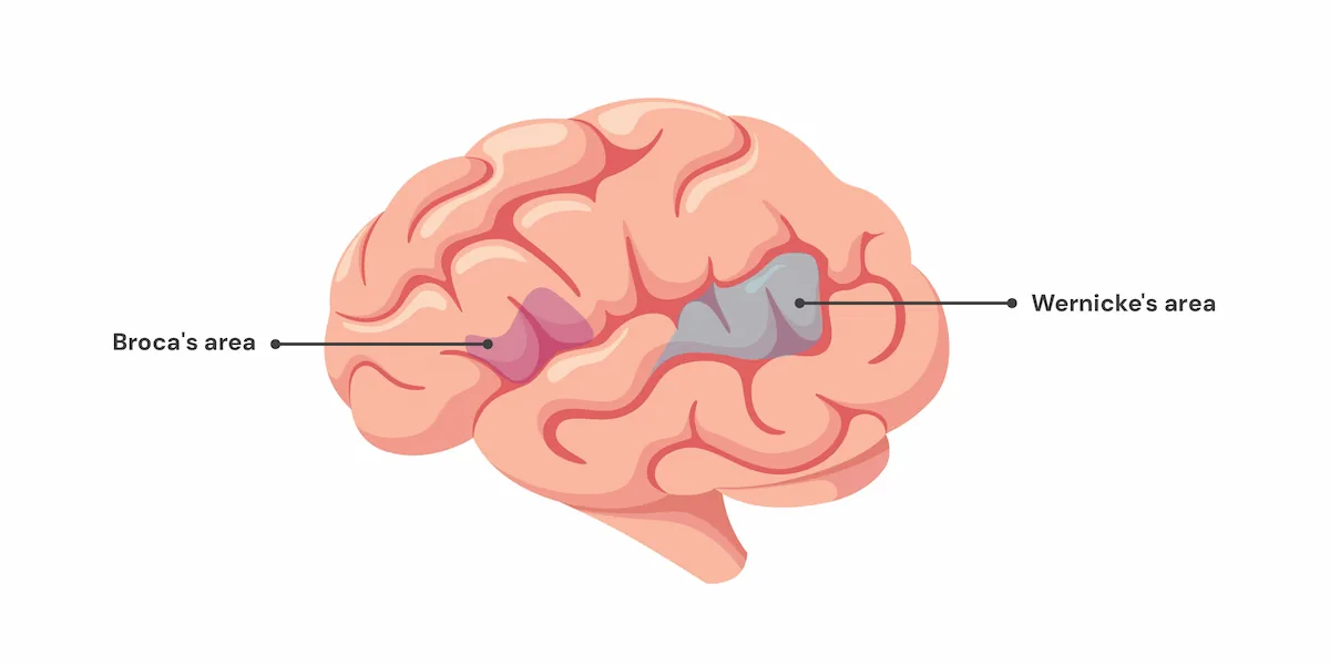 <p>Broca's area</p>
