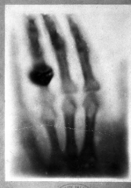 <p>his wife anna bertha’s hand </p>