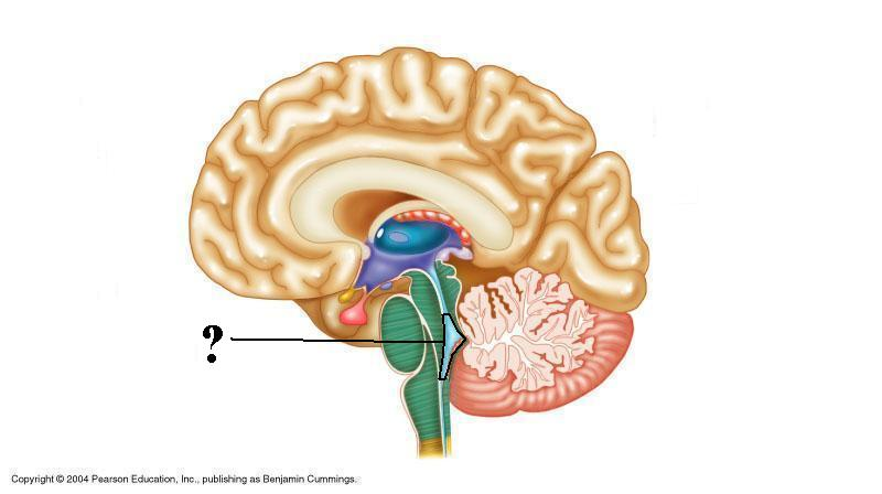 <p>Identify the indicated space of the brain</p>