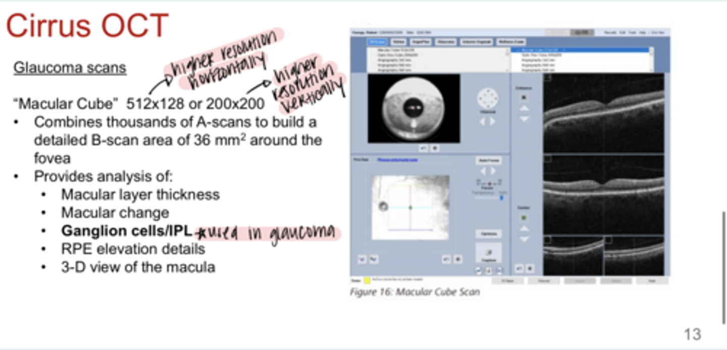 <p>Macular Cube Scans provide analysis for what?</p>