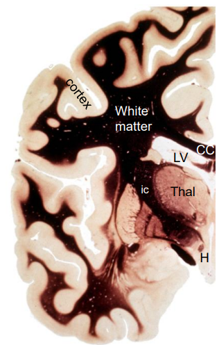 <p>Boundaries of thalamus</p>