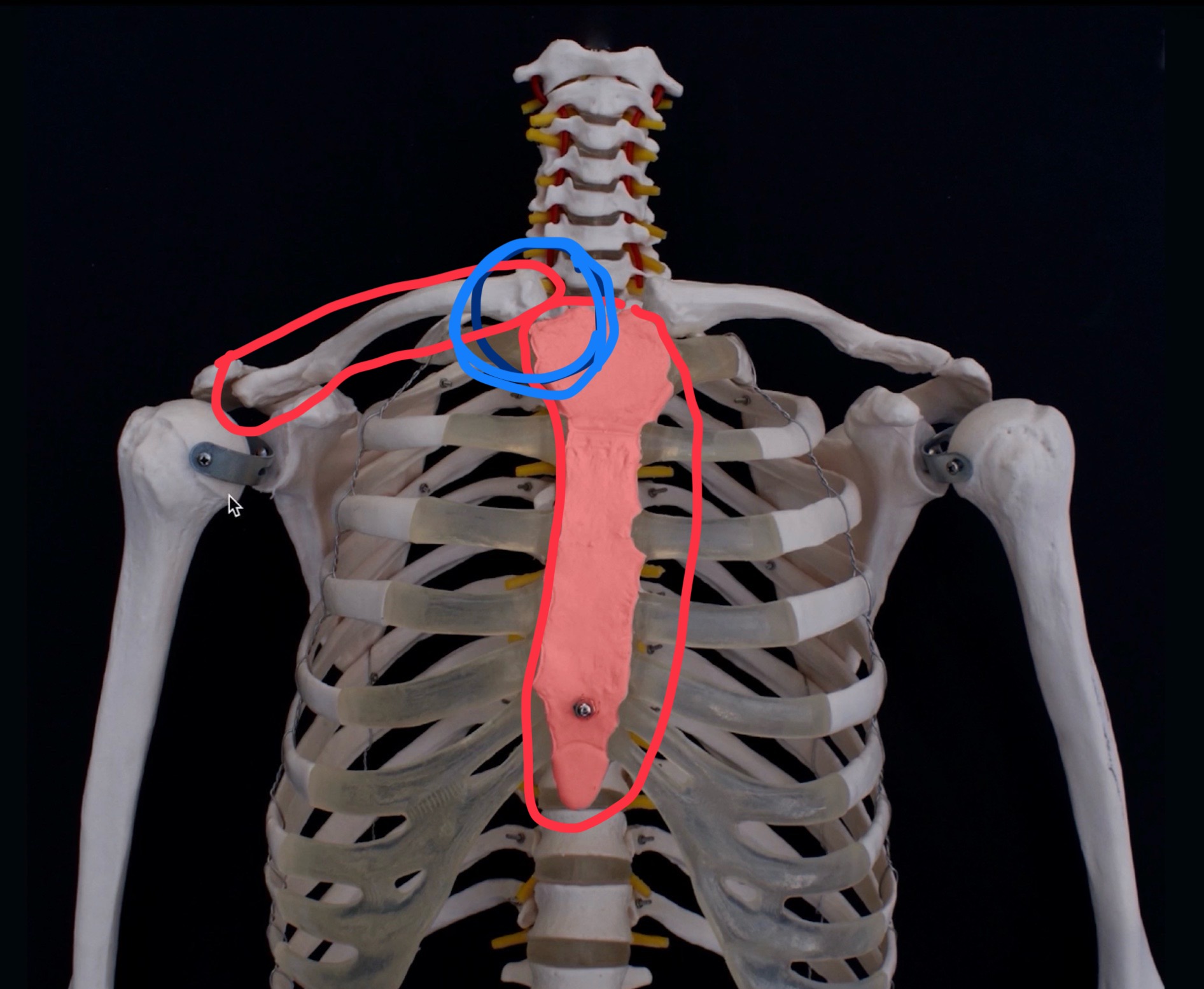 <p>What is the name of this joint and what type of joint is it?</p>
