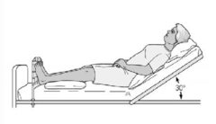 <p>A semi-sitting position with the head of the bed elevated about 15 - 30 degrees.</p>