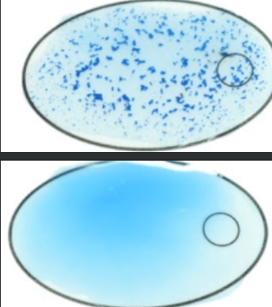<p><span>If you have identified a Gram positive staphylococci that is positive in the catalase test, you will perform a coagulase test.&nbsp; Which of the following is a positive coagulase test?</span></p>