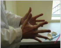 <p>Physiologic. 2 transverse axes. Sphenoid and occiput (the midline bones) rotate opposite of each other. Fingers will point downward, palms move laterally, and fingers spread apart</p><p></p><p>Extra Info for Comp:</p><p>Occurs during inhalation. During flexion, sphenoid will rotate forward/anterior and occiput will rotate backward/posterior. Paired bones will externally rotate. Spheno-basilar junction will move superiorly.</p><p>AP diameter of cranium narrows. Lateral diameter of cranium widens.</p><p>As sphenoid flexes forward, it will pull on dural attachments (C2, C3, and S2) and cause counternutation of the sacrum (sacrum will rotate backwards and slightly superiorly)</p>