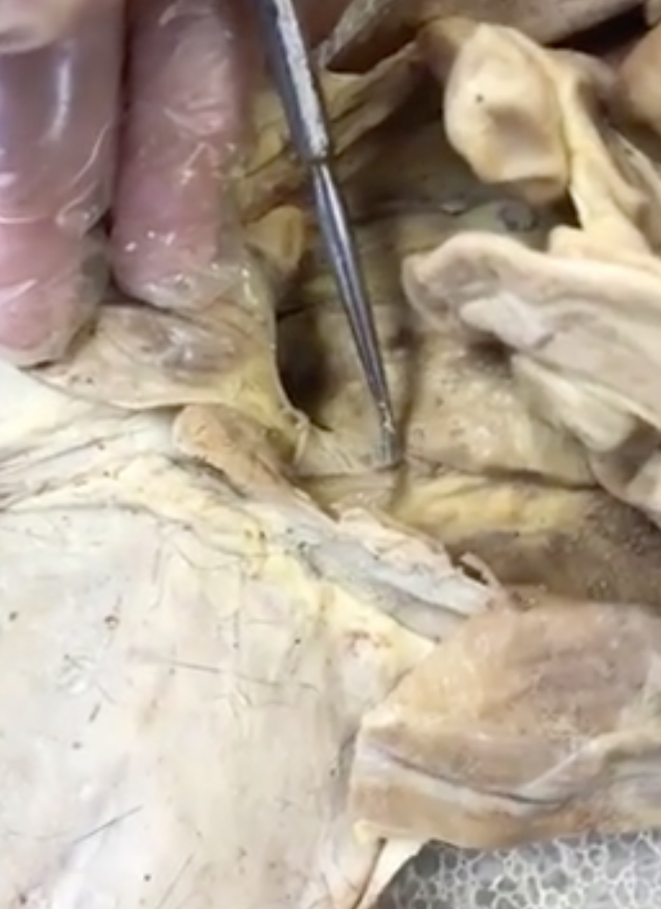 <p>what “string” structure is the prong touching</p>