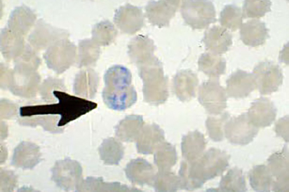 <p>Identify the parasite and describe where is it found/what it infects:</p>