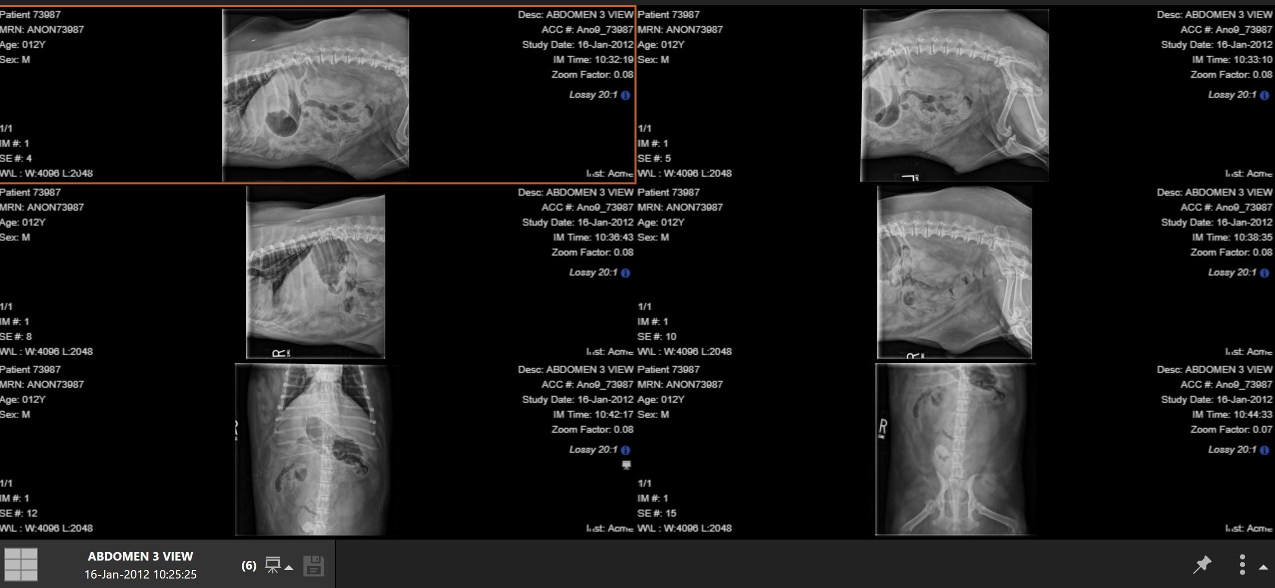 <p>12 YO MN welsh corgi hit by car: between the caudoventral abdominal wall and penis, is there a homogenous or heterogenous increase or decrease in what opacity</p>