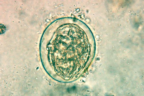 <ul><li><p>Rudimentary lateral (knob-like) spine</p></li><li><p>a small, poorly developed lateral spine</p></li><li><p>appears like a tiny knob, not sharp or obvious</p></li></ul><p></p>