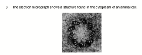 <p><strong>Q:</strong> The electron micrograph shows a circular structure containing nine groups of microtubules. What is it?</p><p><strong>A:</strong> Centriole<br><strong>B:</strong> Lysosome<br><strong>C:</strong> Ribosome<br><strong>D:</strong> Vesicle</p>