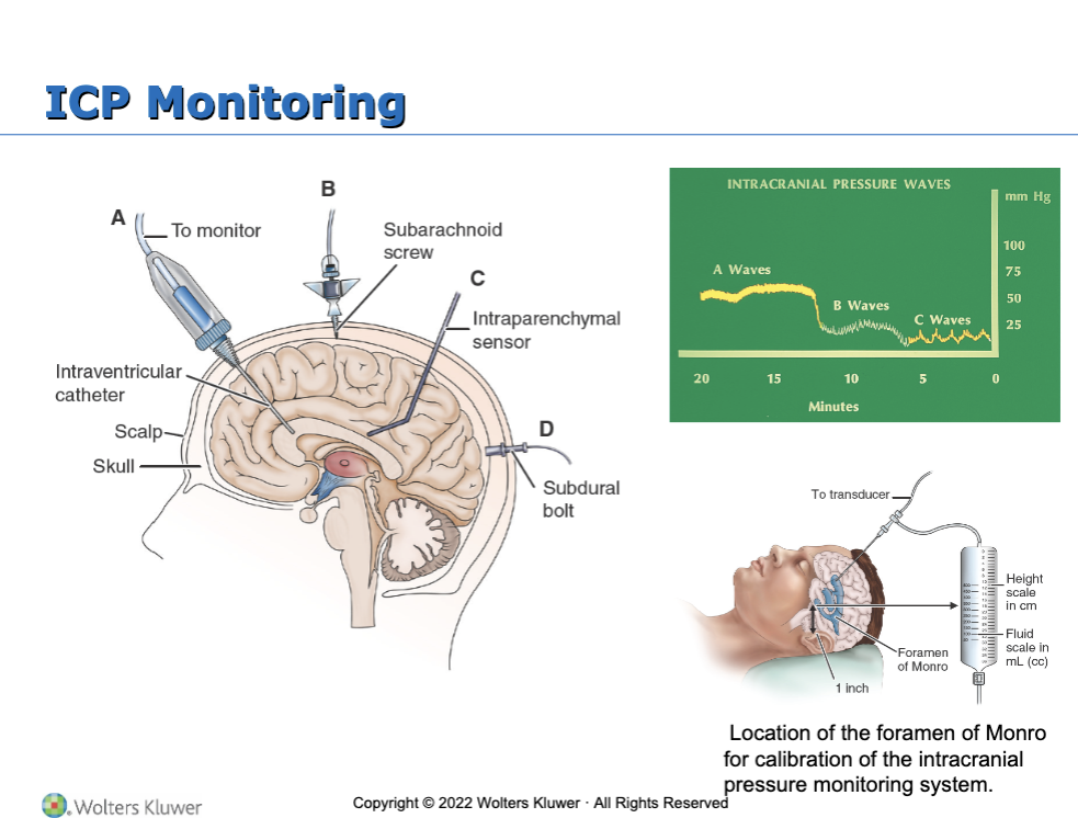 <ul><li><p>Obtain history of events leading to illness</p></li><li><p>Evaluate mental status, LOC</p></li><li><p>Assessment of selected cranial nerves</p></li><li><p>Assess cerebellar function, reflexes, motor and sensory function</p></li><li><p>Glasgow Coma Scale, pupil checks</p></li><li><p>Frequent vital signs</p></li><li><p>Assessment of intracranial pressure</p></li></ul><p></p>
