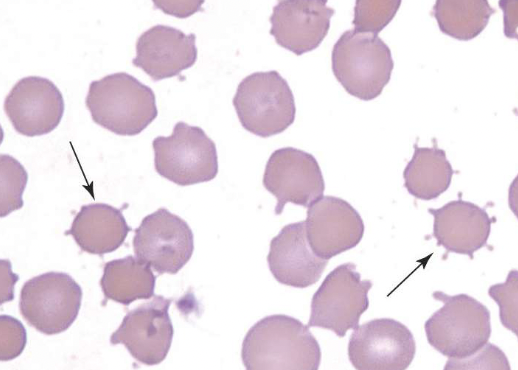 <p>name the type of RBC</p>
