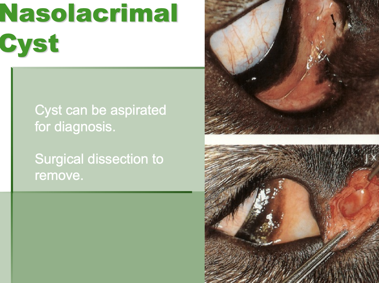 <p>can be aspirated for dx.</p><p>Surgical dissection to remove.</p>