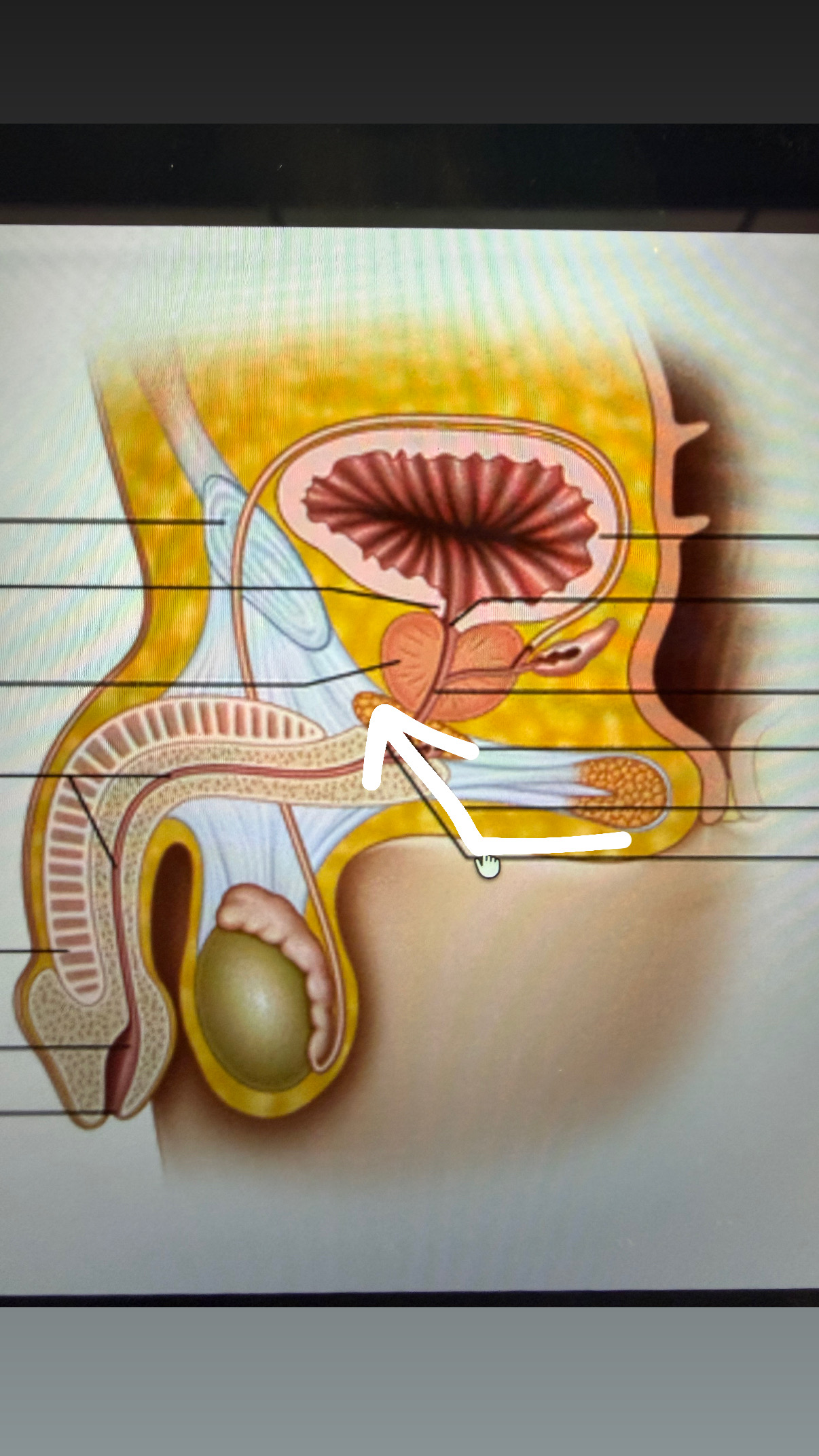 <p>fat looking thing under prostate</p>