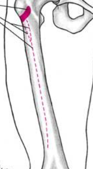 <p>intertrochanteric line, linea aspera</p>