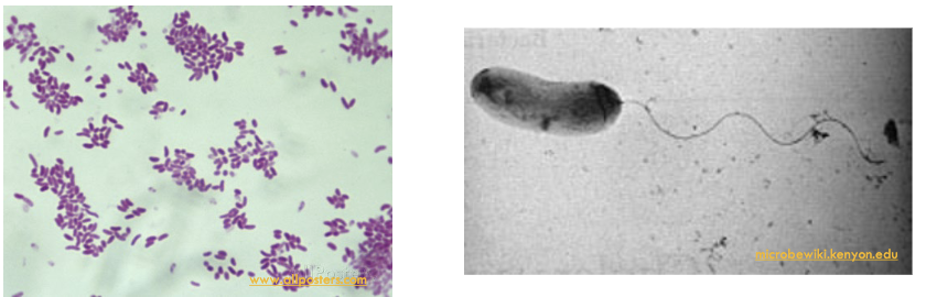 <p>which species of vibrio is described:</p><ul><li><p>straight to slightly curved with a single polar flagellum </p></li><li><p>motile </p><ul><li><p>pili </p></li></ul></li><li><p>mucosinase </p></li><li><p>bloody stools/fever not usually not present (non-invasive bacteria)</p></li></ul><p></p>